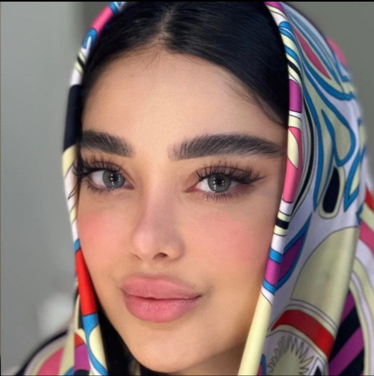 لنز رنگی رز طوسی دور مشکی چرسی گری