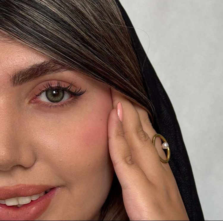 لنز رنگی رز سبز دور مشکی ارکید گرین