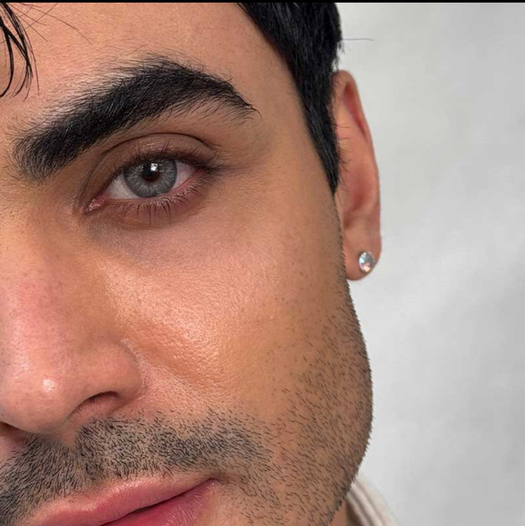 لنز رنگی رز طوسی دور مشکی سندی گری