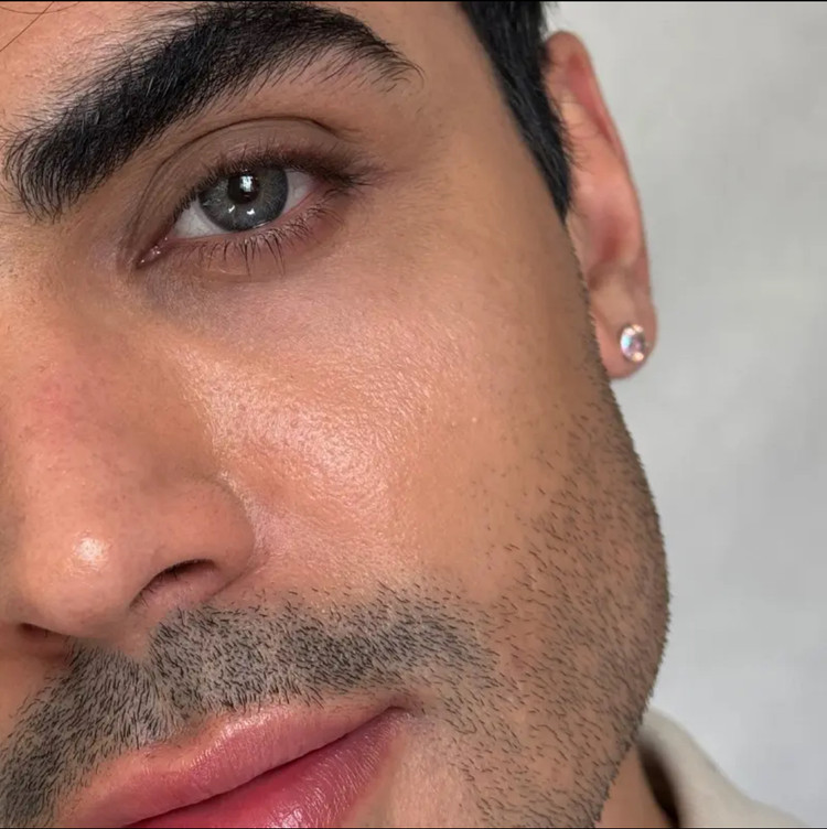 لنز رنگی رز سبز دور مشکی آلیس گرین