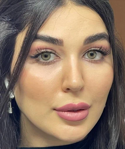 لنز رنگی فصلی دهب رنگ نچرال گرین